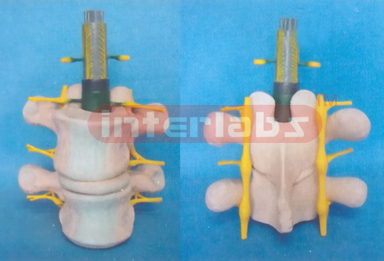 NORMAL LUMBAR COLUMN, ANATOMICAL ANDMAGNIFIED